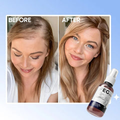 FEG Hair Growth Spray Plus Derma Roller Pack of 2 Suitable For Both Men and Women